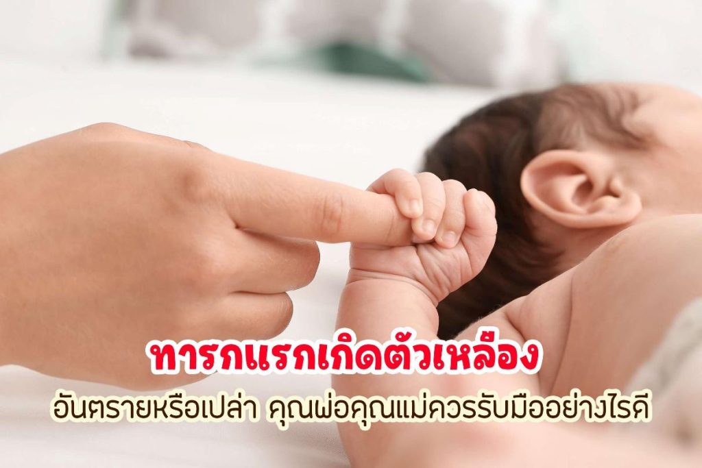 ทารกแรกเกิดตัวเหลือง อันตรายหรือเปล่า