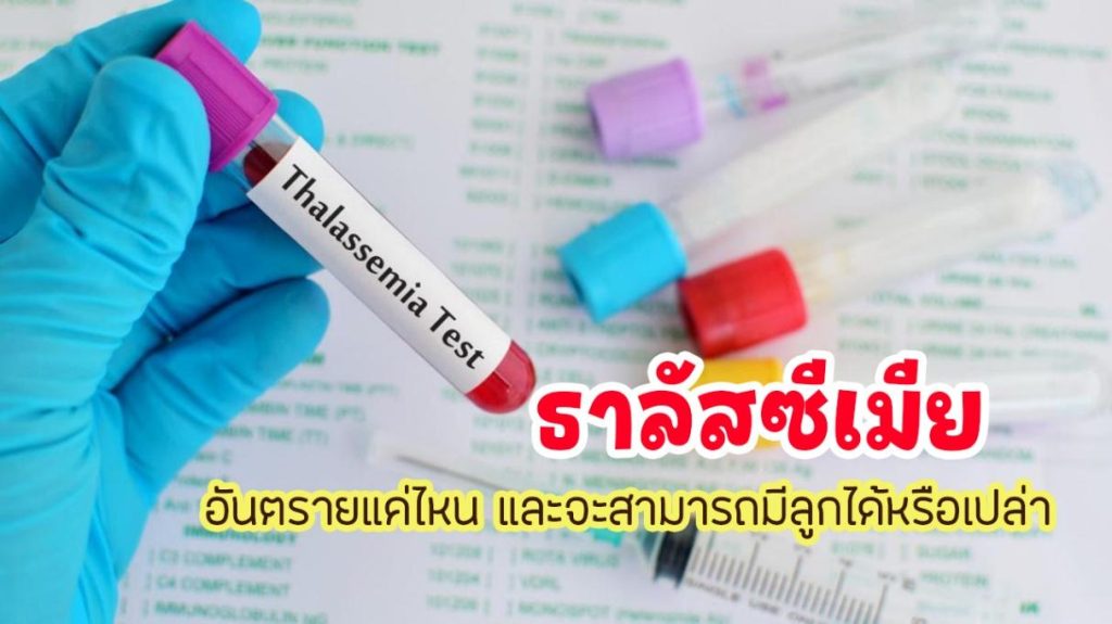 ธาลัสซีเมีย